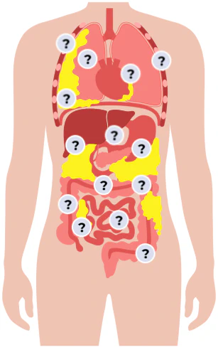 Body diagram